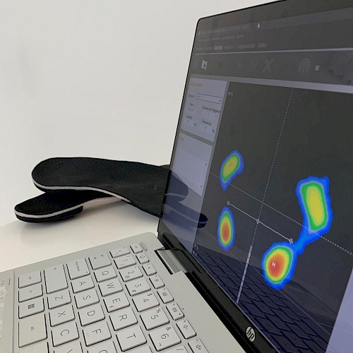 Exploración baropodométrica